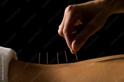 ACUPUNCTURE + ADJUNCT THERAPY + MASSAGE THERAPY